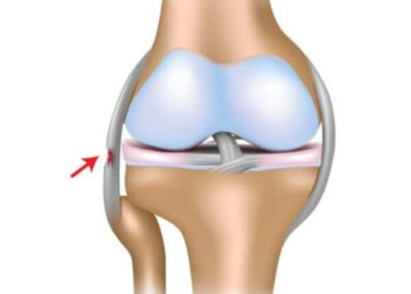 FCL Injury | Austin TX