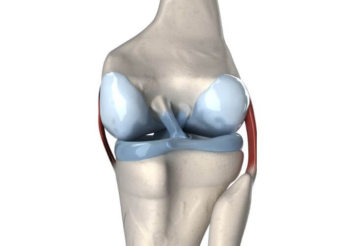 Multi-Ligament Knee Injuries | Austin TX