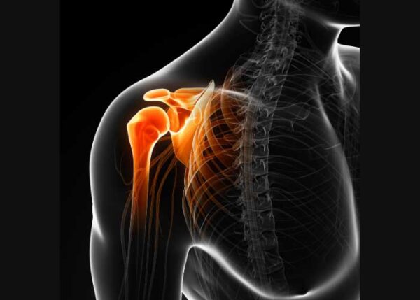 Rotator Cuff Tear Treatment in Dallas, Frisco, Prosper, and Wylie