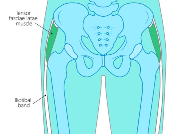 IT Bands and Hip Bursitis